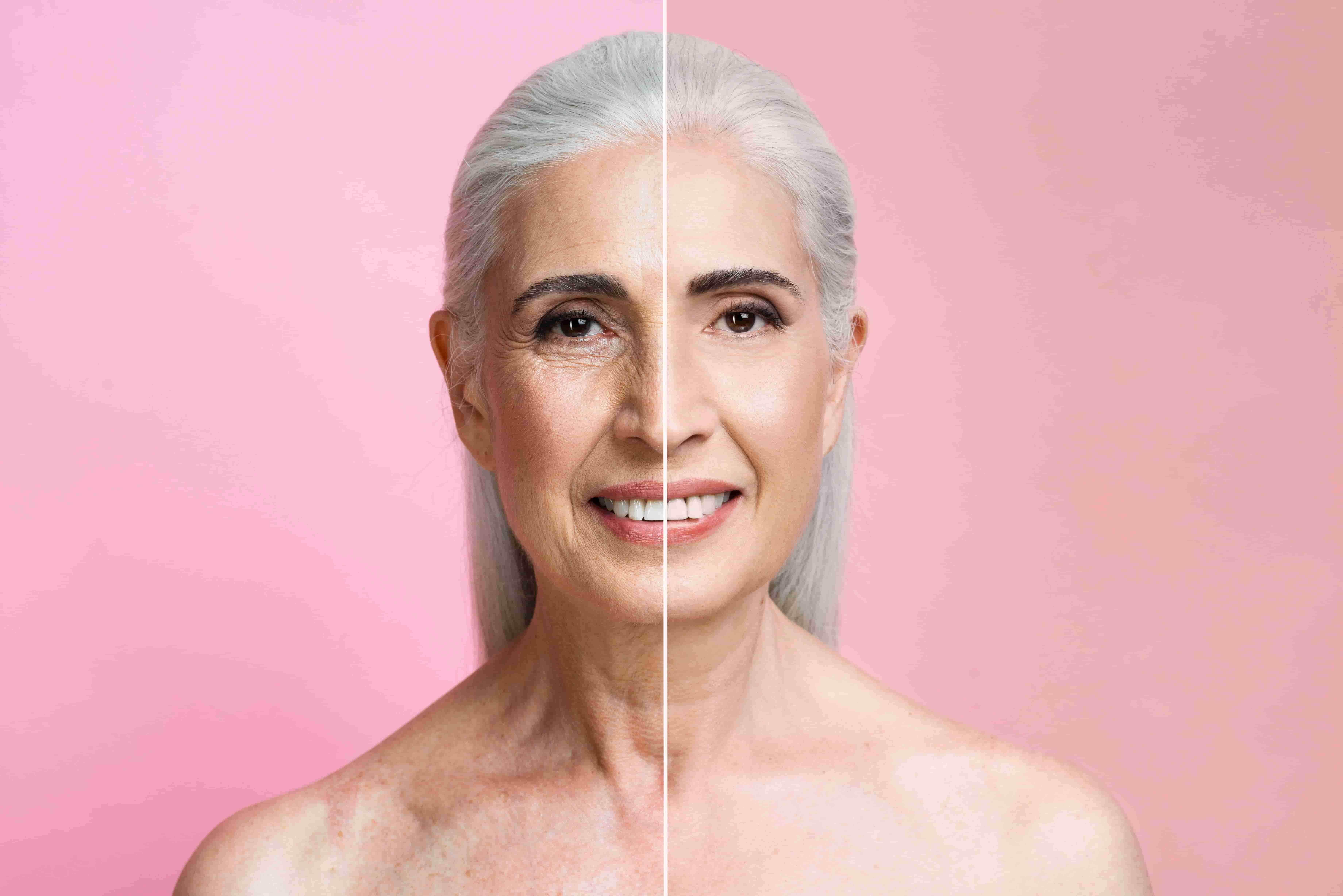 Face lifting & Freshening